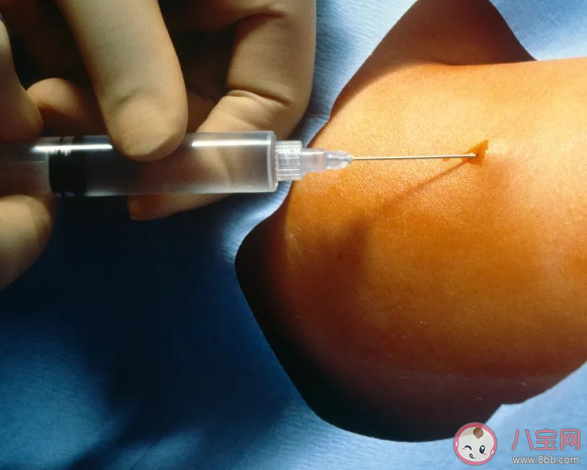 皮下埋植避孕針避孕效果高不高 皮埋避孕法有效期是多長 皮下埋植避孕針避孕效果高不高 皮埋避孕法有效期是多長