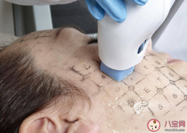 熱瑪吉是所有人都適合做嗎 熱瑪吉的作用原理及主要功能是什么 熱瑪吉是所有人都適合做嗎 熱瑪吉的作用原理及主要功能是什么