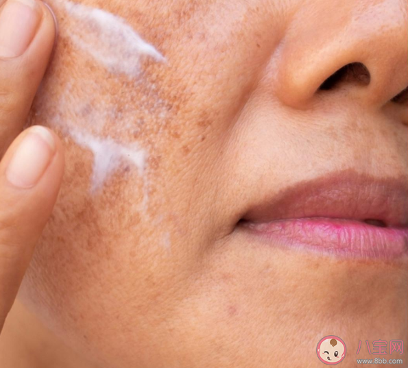 臉上長斑怎么淡斑 淡斑需要注意什么