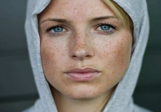 臉上長斑怎么淡斑 淡斑需要注意什么