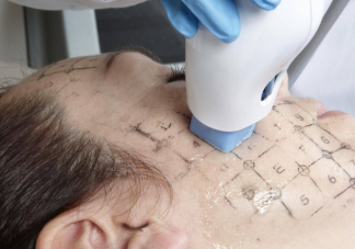 熱瑪吉是所有人都適合做嗎 熱瑪吉的作用原理及主要功能是什么