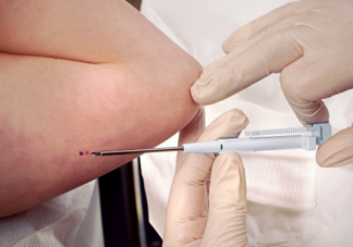 取出皮埋避孕針多久能懷孕 什么時候需要取出避孕針