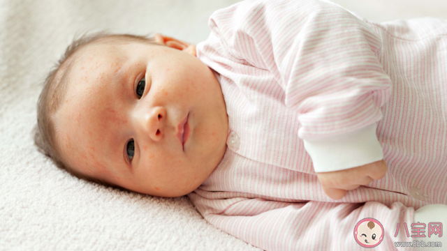 孩子洗澡水里滴去痱水可以預防長痱子嗎 洗澡水里滴去痱子水有用嗎