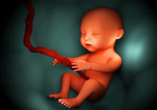 胎兒臍帶繞頸能自己繞出來嗎 什么情況可以繞出來