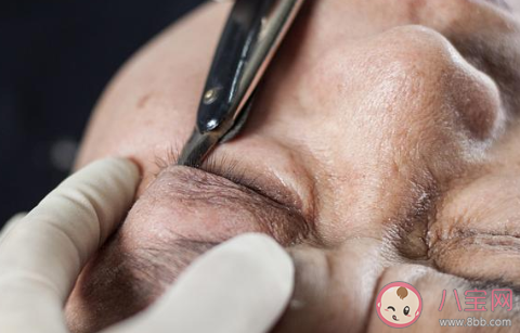 高考生暑期扎堆割雙眼皮怎么回事 男生也割雙眼皮嗎