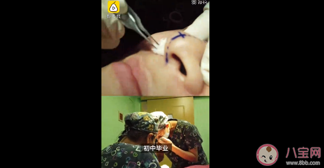 為什么整容低齡化趨勢明顯 年齡多少歲以下不建議整容 為什么整容低齡化趨勢明顯 年齡多少歲以下不建議整容