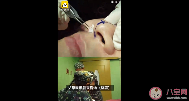 為什么整容低齡化趨勢明顯 年齡多少歲以下不建議整容 為什么整容低齡化趨勢明顯 年齡多少歲以下不建議整容