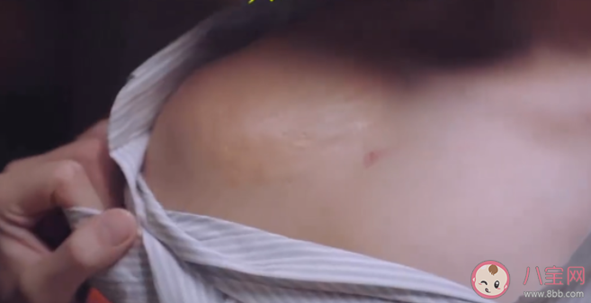 以家人之名凌霄吃藥是怎么了 凌霄身上的疤痕是怎么回事