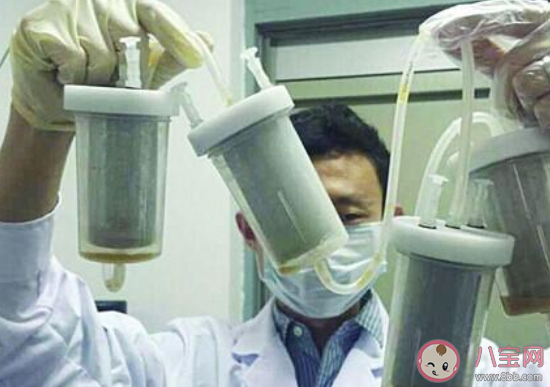 無錫一醫院號召捐獻糞便救人怎么回事 糞便救人是什么原理