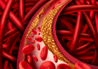血管堵了輸液沖一沖管用嗎 血管堵塞輸液有用嗎