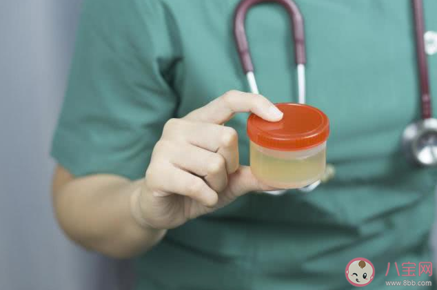 尿可以被稀釋成水嗎 尿液形成過程是怎樣的