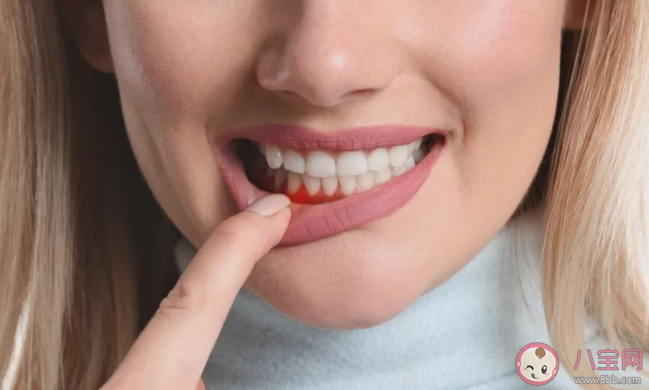 我國九成以上成年人有牙周疾病是真的嗎 成年人得牙周疾病的主要原因是什么 我國九成以上成年人有牙周疾病是真的嗎 成年人得牙周疾病的主要原因是什么