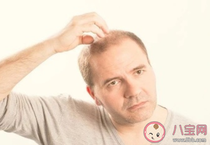 美杜莎的中年煩惱是什么意思 關于脫發的心情說說 美杜莎的中年煩惱是什么意思 關于脫發的心情說說