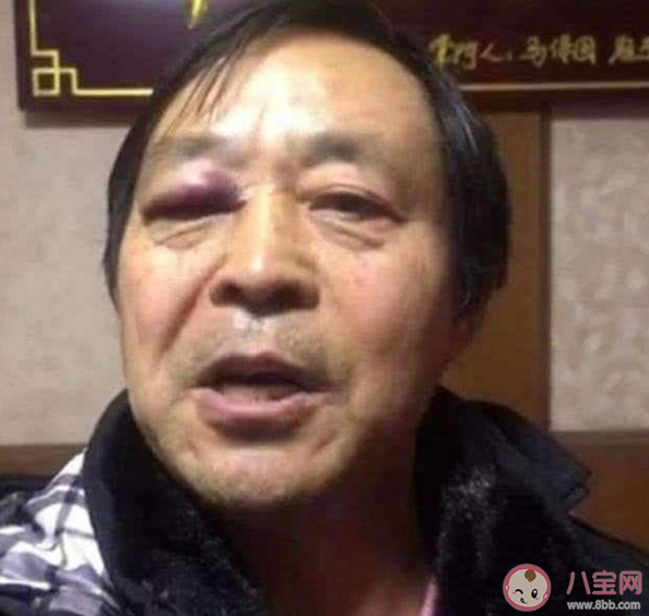 耗子尾汁是什么意思 耗子尾汁是什么梗 耗子尾汁是什么意思 耗子尾汁是什么梗