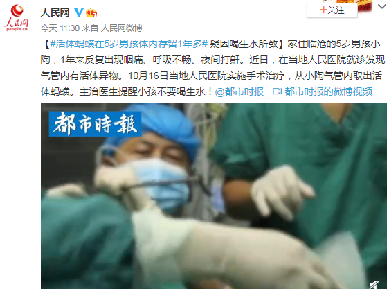 活體螞蟥在5歲男孩體內存留1年多是真的嗎 喝生水有哪些危害