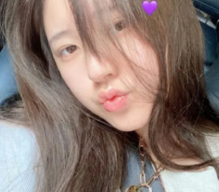 趙露思為何會誤食散粉過敏 皮膚過敏應(yīng)該怎么辦