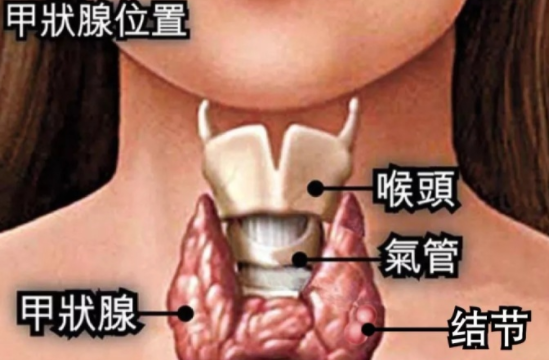 體檢出現增生結節等異常要緊嗎 查出結節增生怎么辦