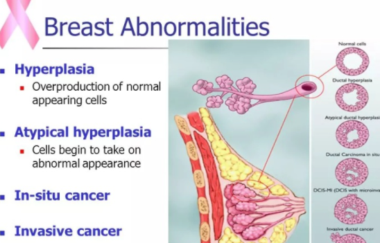 體檢出現增生結節等異常要緊嗎 查出結節增生怎么辦