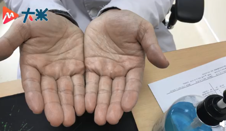 兒科醫生每天洗手超100次是為什么 洗手次數太多的危害