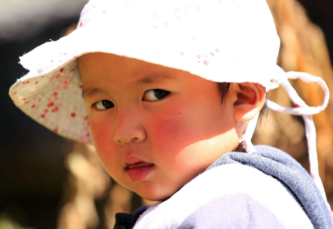 為什么寶寶一到冬天就變丑了 冬天怎么做好寶寶皮膚保濕護理