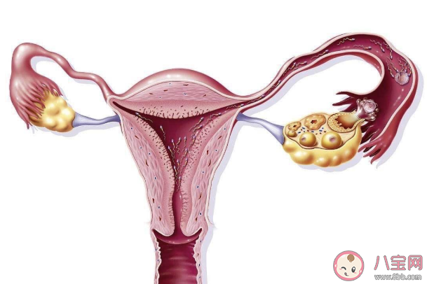 熬夜玩游戲會終身不孕嗎 長期熬夜會卵巢早衰嗎 熬夜玩游戲會終身不孕嗎 長期熬夜會卵巢早衰嗎