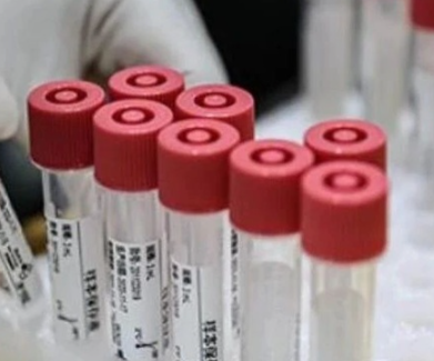 湖北核酸費用降價到多少錢 回湖北需要核酸檢測證明嗎