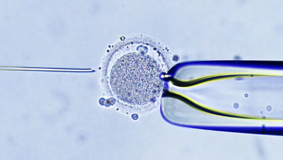 為什么要反對代孕合法化 代孕不能被放開的原因 為什么要反對代孕合法化 代孕不能被放開的原因