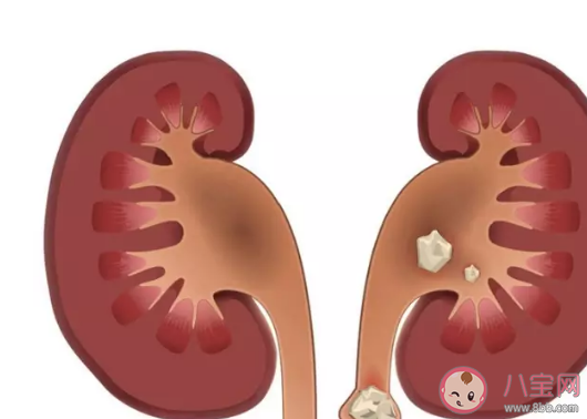 尿毒癥出現(xiàn)年輕化的原因是什么 尿毒癥最多能活幾年 尿毒癥出現(xiàn)年輕化的原因是什么 尿毒癥最多能活幾年