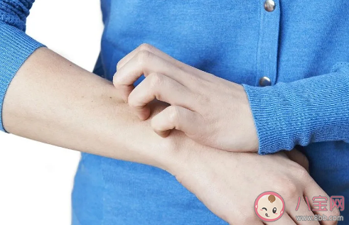 濕疹是不是濕熱引起的嗎 干性濕疹的癥狀是什么 濕疹是不是濕熱引起的嗎 干性濕疹的癥狀是什么