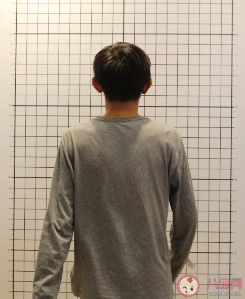 脊柱彎曲納入全國學生常見病監(jiān)測 怎么及早發(fā)現(xiàn)孩子脊柱側(cè)彎