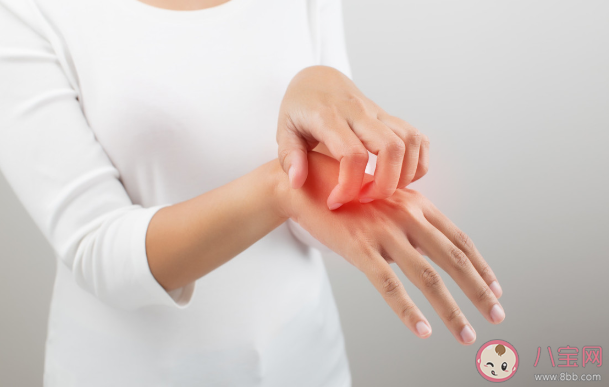 過敏性皮炎用什么藥好 過敏性皮炎患者如何做好生活管理