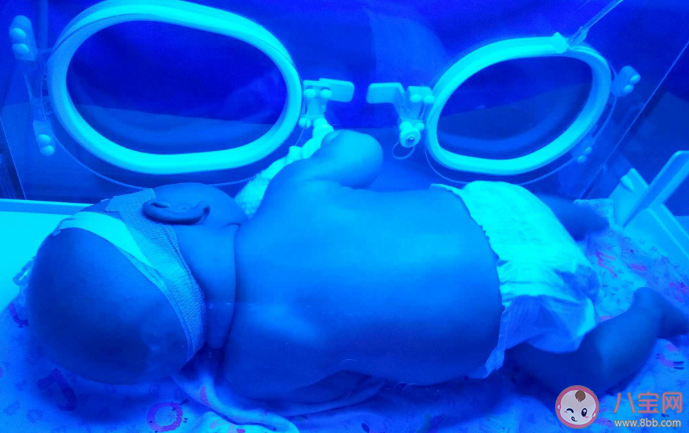 新生兒黃疸藍(lán)光要照幾天 新生兒黃疸買個(gè)藍(lán)光燈在家照可以嗎