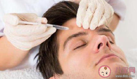 男青年最熱衷的醫(yī)美項目是植發(fā)嗎 植發(fā)后有哪些注意事項