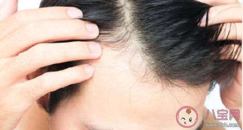 男青年最熱衷的醫(yī)美項目是植發(fā)嗎 植發(fā)后有哪些注意事項