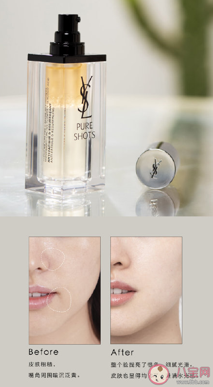 YSL夜皇后精華適合油痘肌嗎 YSL夜皇后精華好用嗎 YSL夜皇后精華適合油痘肌嗎 YSL夜皇后精華好用嗎