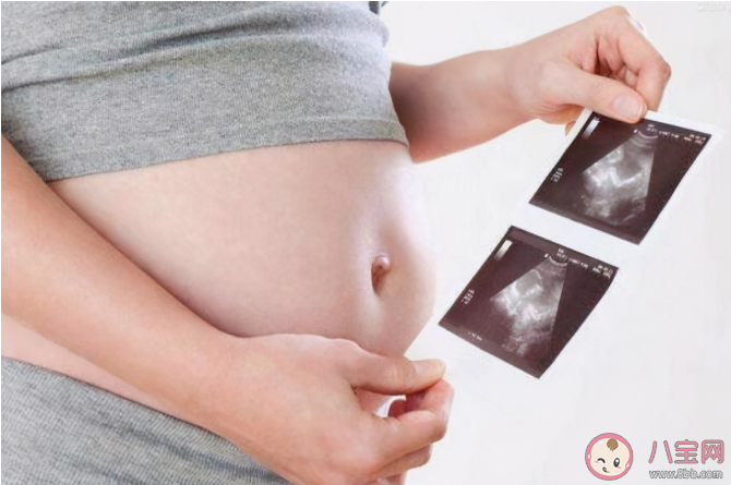 寶寶股骨短就代表腿短嗎 寶寶腿短和什么有關系