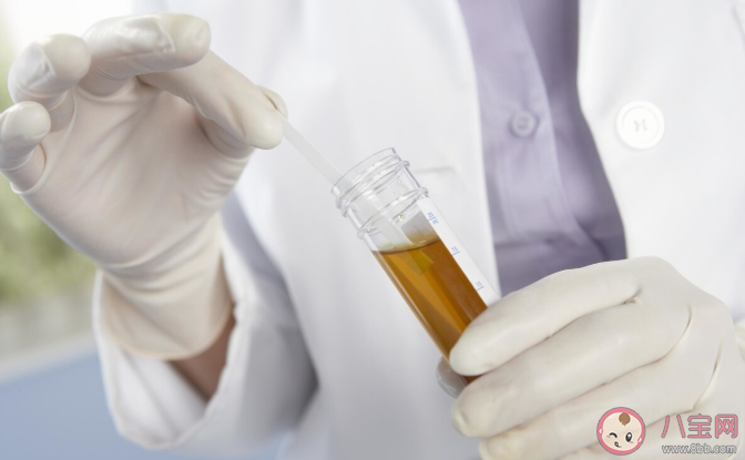 哪些情況要警惕腎臟有問題 慢性腎臟病的常見原因有哪些