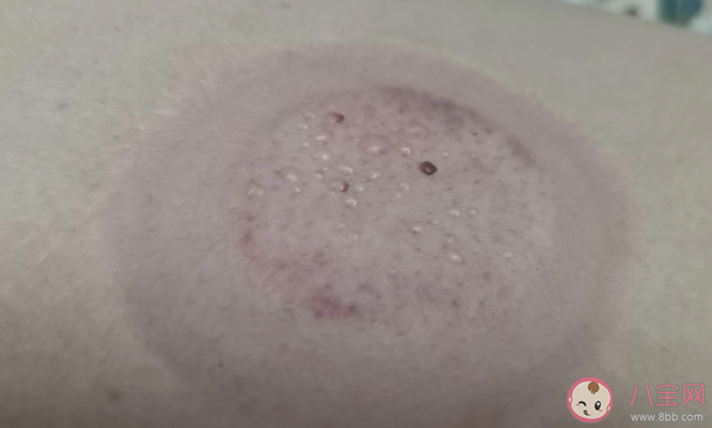 春季是除濕的好時節嗎 為什么春天容易濕氣重 春季是除濕的好時節嗎 為什么春天容易濕氣重