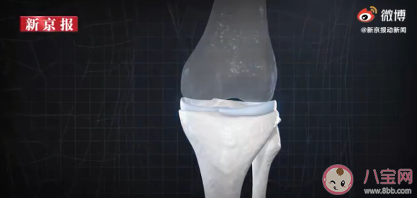 年輕人成半月板損傷主要人群是怎么回事 如何保護半月板避免受傷 年輕人成半月板損傷主要人群是怎么回事 如何保護半月板避免受傷