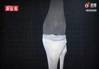 年輕人成半月板損傷主要人群是怎么回事 如何保護半月板避免受傷