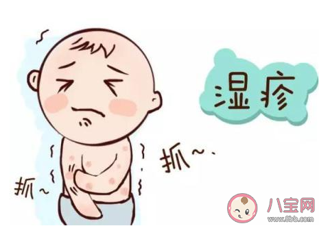 怎樣鑒別新生兒面皰和濕疹 面皰和濕疹具體區別是什么