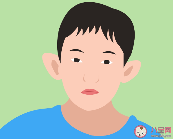 睡覺壓耳朵會變招風(fēng)耳嗎 招風(fēng)耳會影響聽力嗎