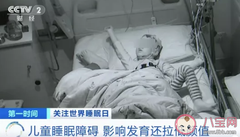 兒童睡不好會拉低顏值變丑嗎 為什么對顏值有影響