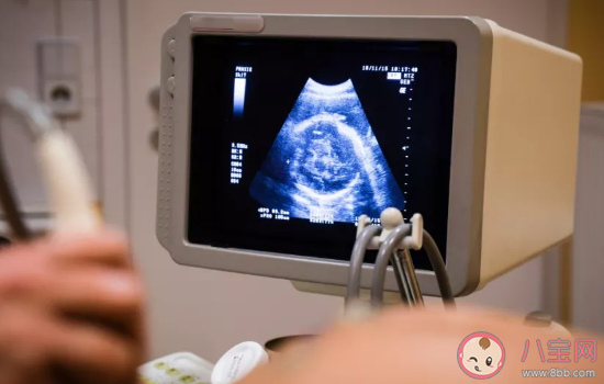 孕期三個(gè)月需要做哪些檢查 夫妻備孕的小技巧