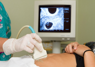 b超懷孕天數可以精確到天嗎 孕期B超檢查時間表