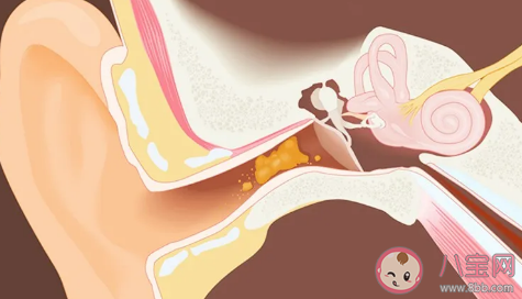 孕期激素變化會導致耳鳴嗎 孕期耳鳴和聽力下降的原因