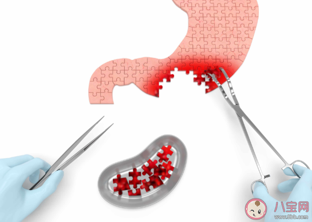 保胃的8個關鍵時間 應杜絕的八條傷胃習慣