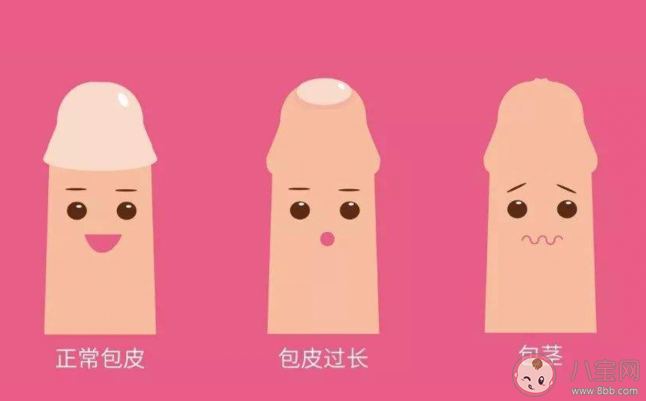 男孩包皮多長算正常 如何定義包皮過長