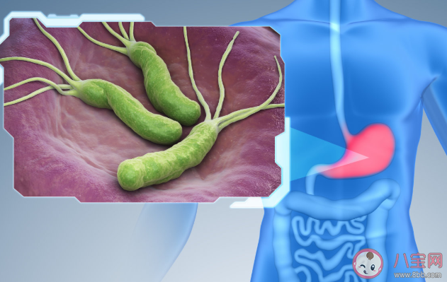 查出幽門螺桿菌要不要治療 檢查幽門螺桿菌感染有哪些方法 查出幽門螺桿菌要不要治療 檢查幽門螺桿菌感染有哪些方法