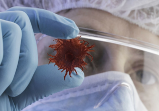 腫瘤早期五大報警信號有哪些 患上腫瘤應該怎么辦